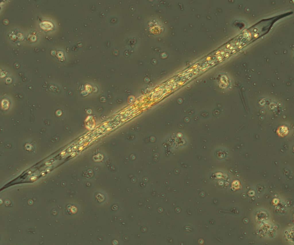 A microscopic image of diatom algae